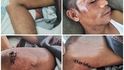 APH Diminta Tegas dan Usut Tuntas, Kasus Pengeroyokan di Eks PT DMP